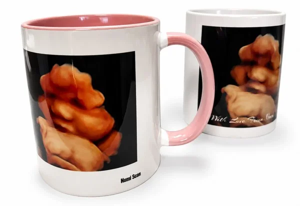 Coloured ceramic keepsake mug printed with a baby scan image