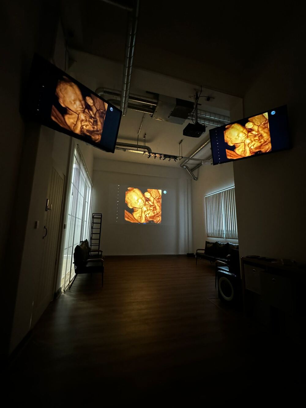 Modern private ultrasound scan room with comfortable bed, ultrasound equipment, and warm ambient lighting