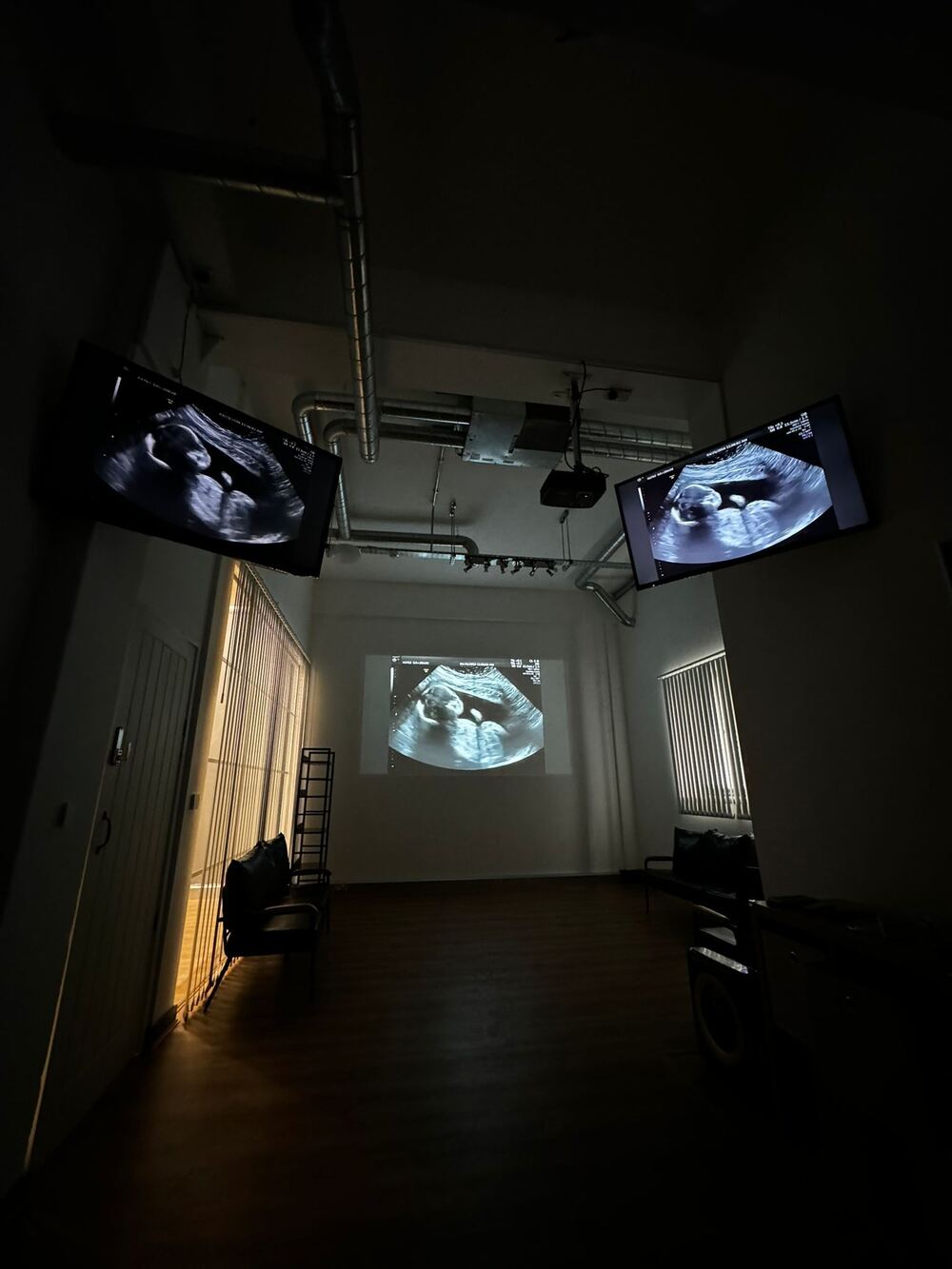 Modern private ultrasound scan room with comfortable bed, ultrasound equipment, and warm ambient lighting